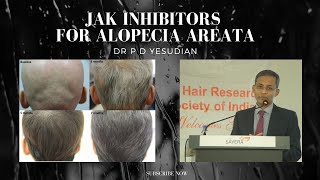 JAK inhibitors for alopecia areata