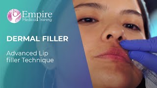 Advanced Lip Filler Technique