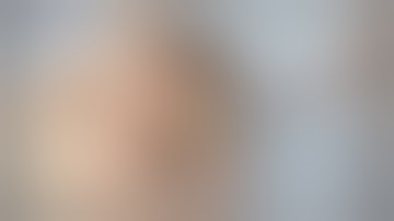 Socket Preservation after Failing Implants - Lateral Augmentation Course Private Academy