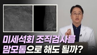 미세석회 조직검사를 맘모톰으로 해도 될까?