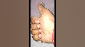 Turmeric & surf excel experiment #shots #ytshot