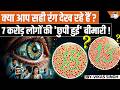 The Invisible Vision Crisis: 7 Crore Indians Don’t Even Know They Have This! | Vikas Singh l StudyIQ