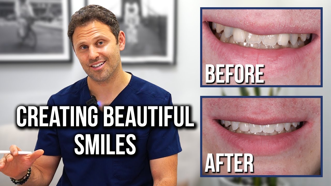 Congenitally Missing Lateral Incisors - Dental Science