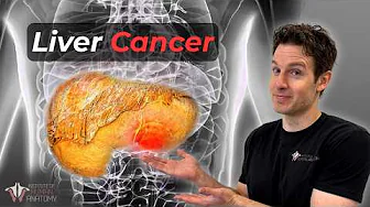 The Liver Cancer You Didn't See Coming — And Why It’s So Deadly