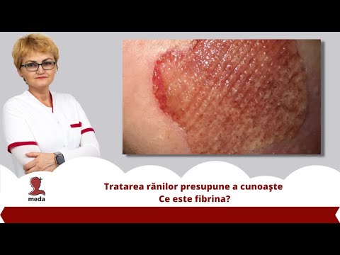 Video: Necroză Fibrinoidă