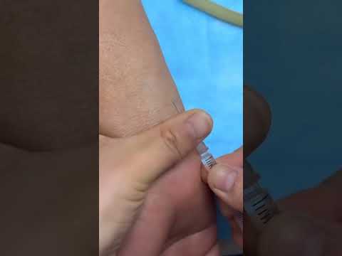 طريقة عمل اختبار الحساسية بسهولة اختبار الحساسية