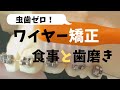 ワイヤー矯正（マルチブラケット）装置の食事と歯磨き