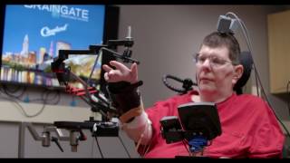 Man with quadriplegia employs injury bridging technologies to move again - just by thinking​