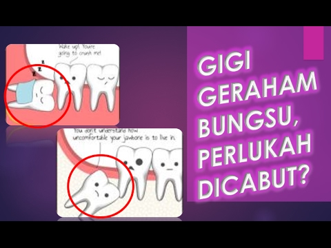 What Gigi Rahang
