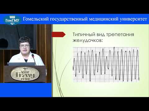 Алейникова Т.В. Дифференциальная диагностика фибрилляции и трепетания желудочков