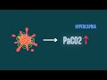 Hypercapnia pathophysiology of co2 retention