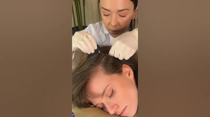 Asmr scalp #relaxing #sleep #asmr #satisfying #relax #tingles #asmrvideos #oddlysatisfying #hair