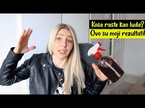 Video: Upoznajte Smileya, divan pas za terapiju bez očiju