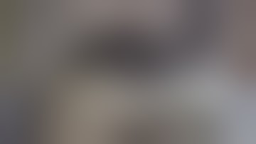 Abdomen Module I Practical 2 I Peritoneum & it