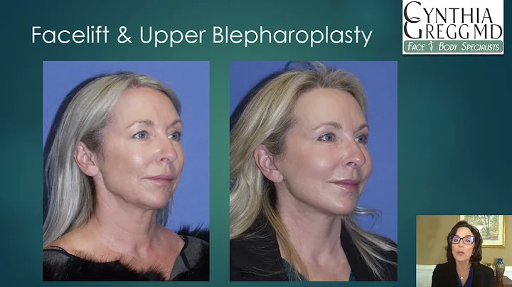 The Decision for Facial Plastic Surgery is Far Fro...