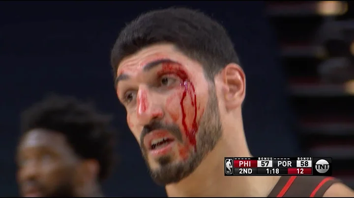 Enes Kanter Gets Stitches After Taking Elbow To Th...