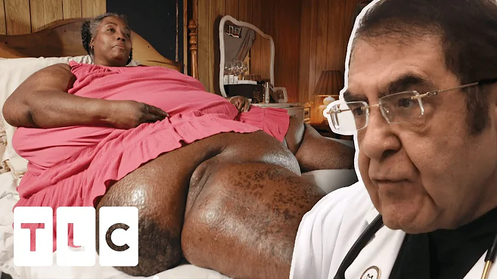 700-LB Patient's Emotional Weight Gain Story After...