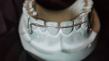 Easy way to fabricate Labial Bow | Method 2 | Short Labial Bow | Orthodontics