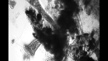 A group of the protozoan Stentor taken using a Leeuwenhoek replica microscope