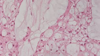 Quiz 7 Soft Tissue Pathology screenshot 1