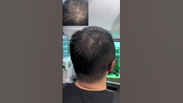 Nói gì đó về sự tuyệt vời mà chúng tôi mang đến. nghệ sĩ hàng đầu về Smp tại Việt Nam! #scalp