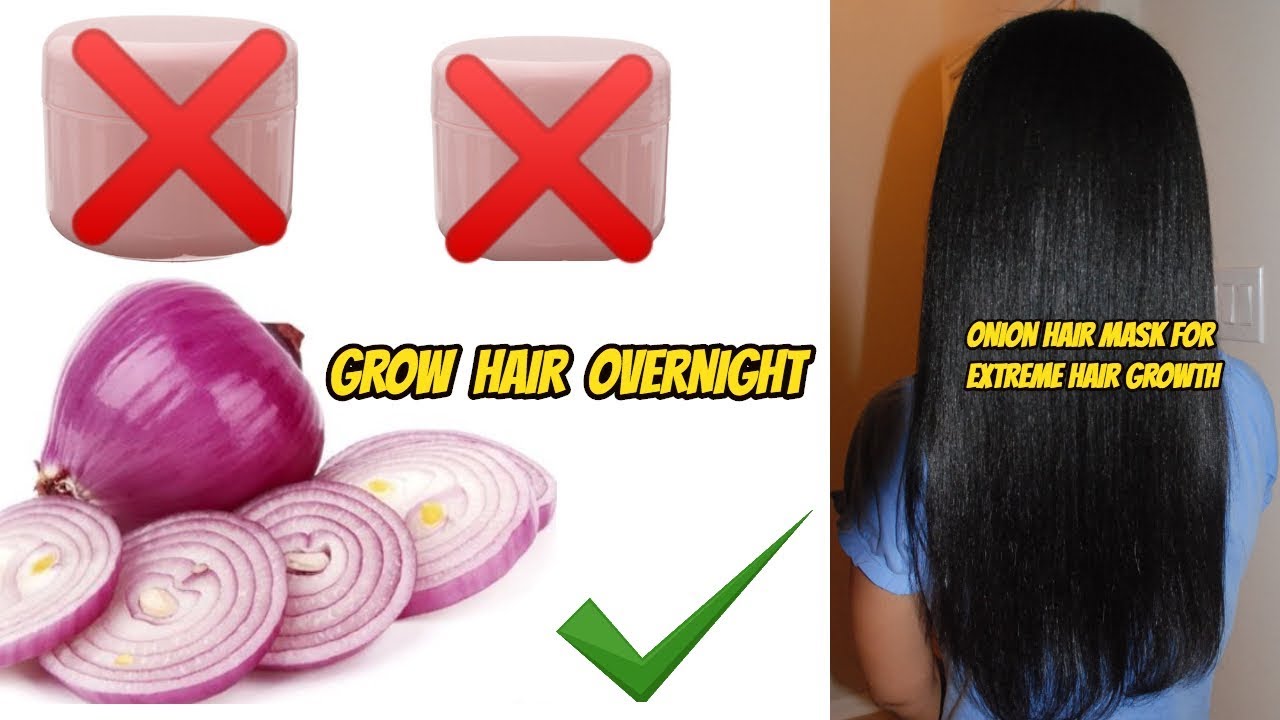 HOW TO GROW HAIR OVERNIGHT| DIY ONION JUICE FOR FAST HAIR GROWTH| IT WORKS  LIKE MAGIC - YouTube