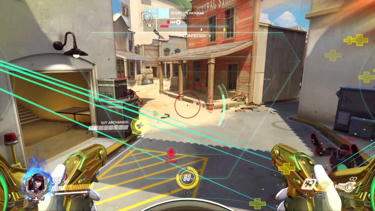 Competitive OverWatch !!! TOP 5 DIVA xbox one