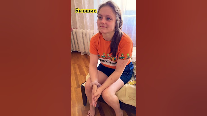 Алина. Расковыряла тело до костей по солями . #алфапвп #наркомания #зависимость #соль