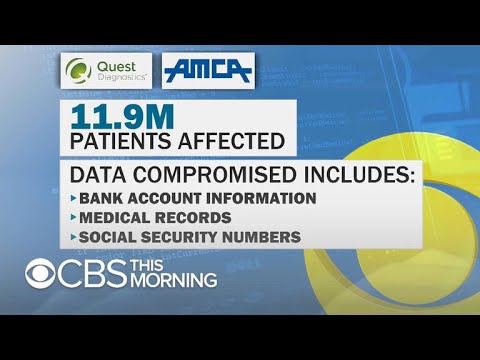 Quest Diagnostics data breach exposes nearly 12 million people