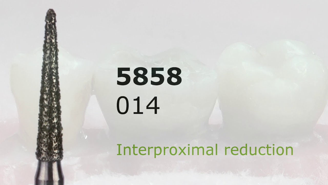 Posterior crown preparation