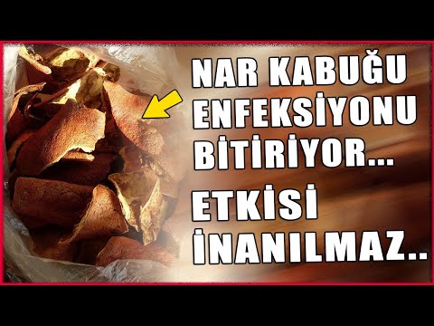 Video: Stresli yaşam neden öğrenmenin ve toplum gelişiminin ayrılmaz bir parçasıdır?