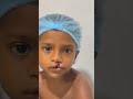 A smart boy is ready for cleft lip surgery in india  dr mathew pc shorts