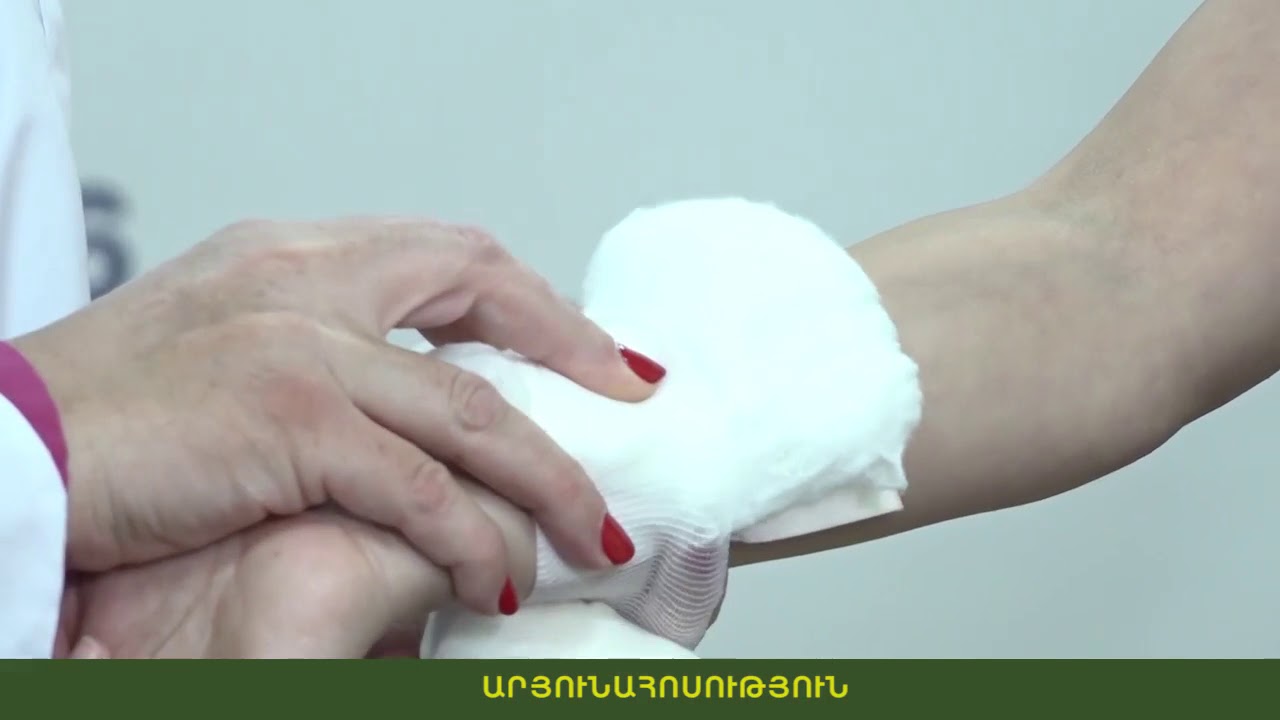 Ինչպե՞ս ցույց տալ առաջին բուժօգնություն արյունահոսության դեպքում. ՄԻՊ-ը տեսանյութ է հրապարակել