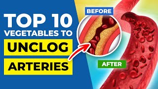 TOP 10 Vegetables to Unclog Arteries by Heart Disease Code 7,826 views 2 weeks ago 16 minutes