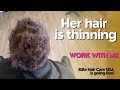 Her hair is thinning | Work with me Elite Hair Care USA is going live!