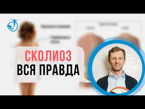 СКОЛИОЗ - Истинная причина возникновения. Как лечить Сколиоз | Владимир Животов