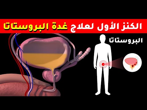 فيديو: سرج رومان المتخصص يطبع ثلاثية الأبعاد