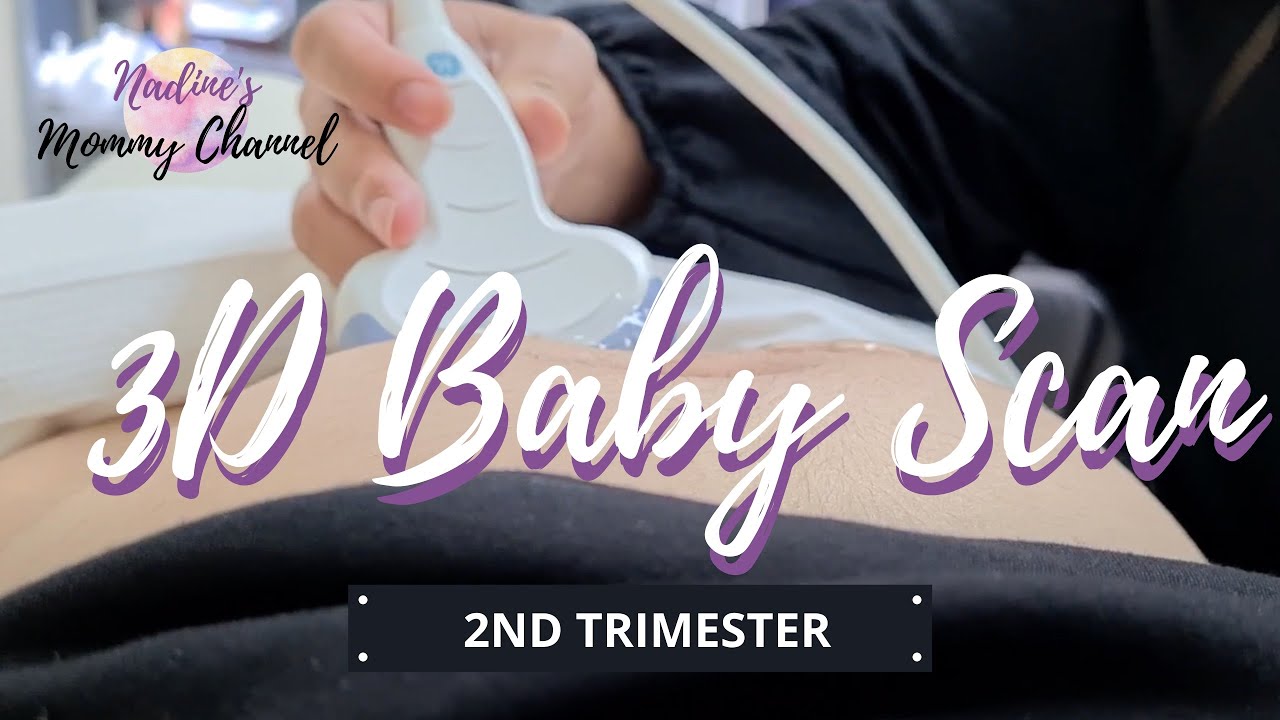 How a 3D Baby Scan looks like at 23 weeks going 24 weeks pregnancy - Singapore 