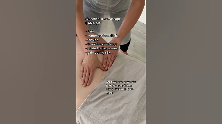 C-section scar massage benefits #csectionrecovery #newmum #newmom #postpartum