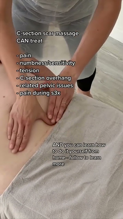C-section scar massage benefits #csectionrecovery #newmum #newmom #postpartum