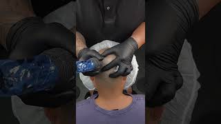 The best hair loss solution- ￼Scalp Micropigmentation- No Down Time-Low Cost #scalpmicropigmentation
