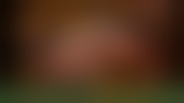 RobotiX Mentor, Robotic Surgery Simulator, Robotic Hysterectomy Procedure Module