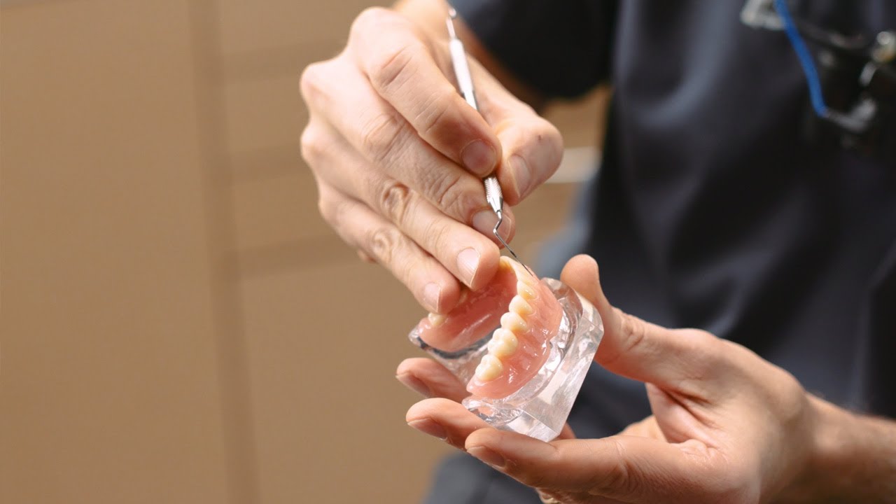 Cosmetic Gum Surgery - YouTube