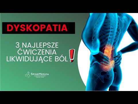 Wideo: 3 sposoby na spanie z pękniętym dyskiem