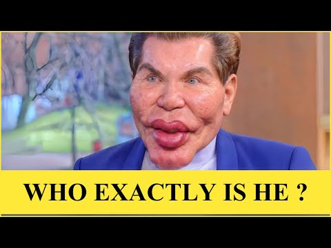 Marlo Thomas Nose Surgery