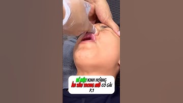 [P.1] Bên trong mũi cô gái là thứ này #shorts