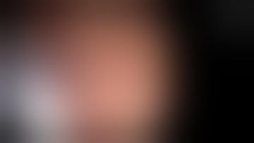 ERC : Ampulla Type IVa Cannulation (Intradiverticular) - TWFC