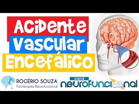 Vídeo: Associação Diferente Do Consumo De álcool Com Diferentes Tipos De AVC: Uma Revisão Sistemática E Metanálise