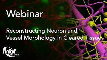 Webinar: Reconstructing Neuron and Vessel Morphology in Cleared Tissue