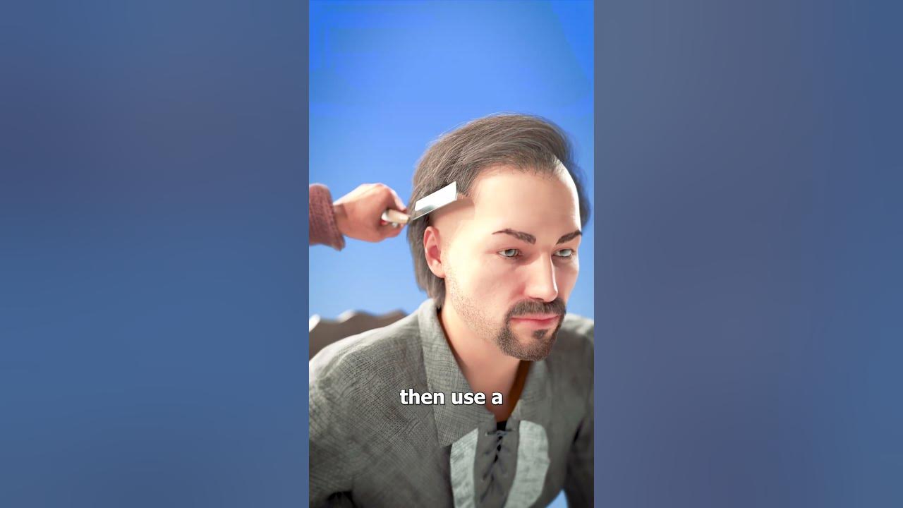 Drilling A Hole In Your Head?? 😨